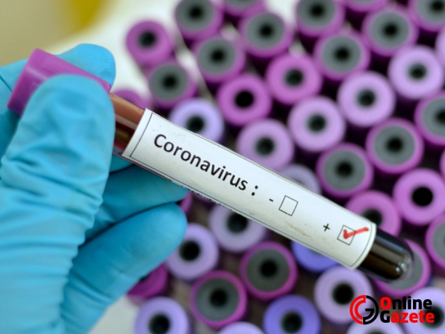Herkesin derdi ayni nedir ve nasıldır bu Coronavirus testi?