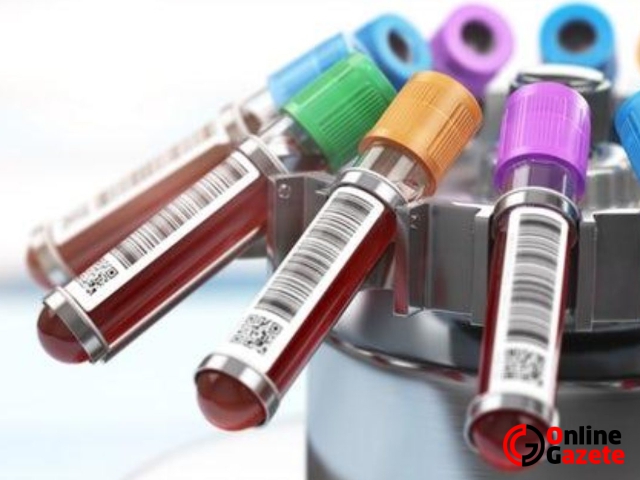 PCR Testlerinde Yetersiz Kaldık