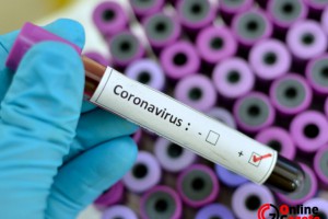 Herkesin derdi ayni nedir ve nasıldır bu Coronavirus testi?