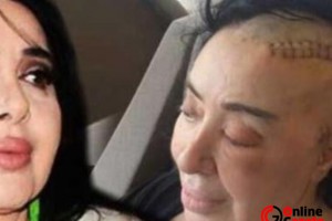 Ölüm haberi yasa boğdu: Nur Yerlitaş kimdir, hastalığı neydi?