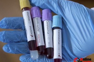 Oralarda hava 30 dereceye varıyor ama vaka sayısı yükselişini sürdürüyor