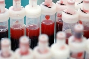 KKTC'de corona virüs yüzünden ilk ölüm açıklandı!