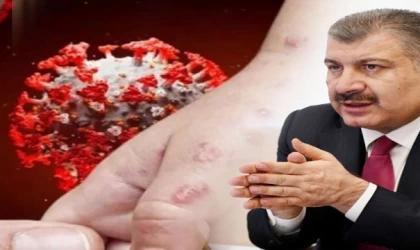 Eris varyantı Türkiye’de