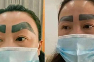 Bir estetik faciası daha